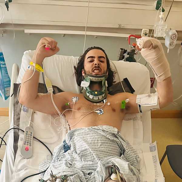 Motorcycle crash survivor fights through weeks of surgeries